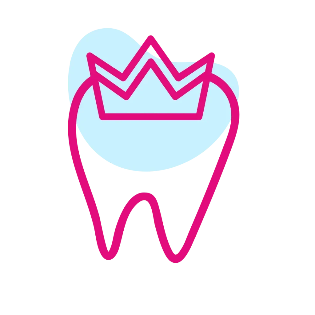 Faccette dentali