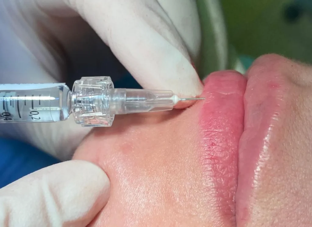 Medicina estetica a Casarano